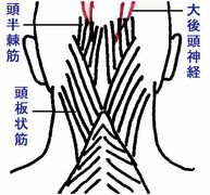 緊張性頭痛