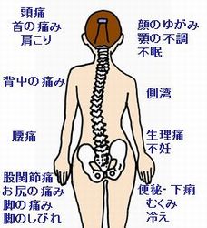 骨盤の歪みとさまざまな体の不調