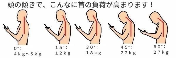 頭の傾きと首への負担