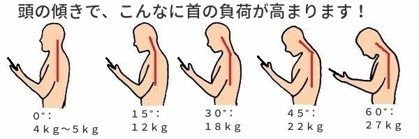 頭の傾きと首への負担