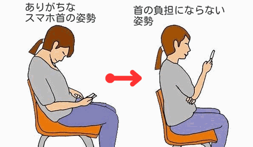 スマホ症候群におけるスマホ首と負担にならない姿勢の対比